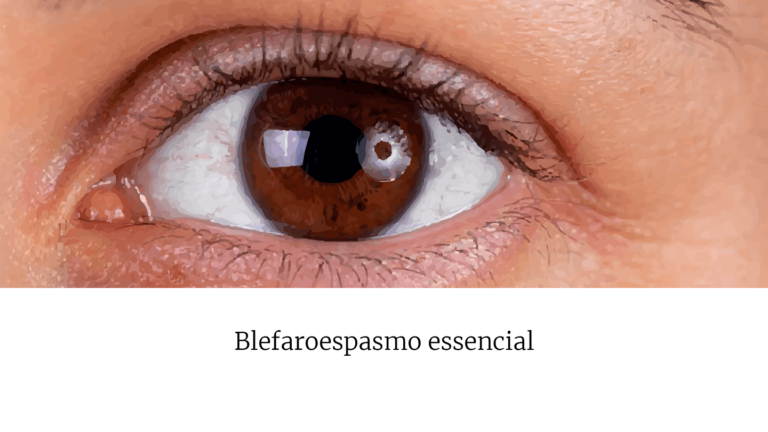 O blefaroespasmo caracteriza-se por contrações involuntárias  dos músculos ao redor dos olhos. Em geral, é bilateral e ocorre com maior frequência em mulheres acima dos 50 anos. Com o passar do tempo, há aumento da frequência do piscar, o que pode levar à cegueira funcional, pela dificuldade de abrir os olhos. O tratamento de escolha é a aplicação da toxina botulínica em pontos-chave para relaxamento da musculatura acometida.